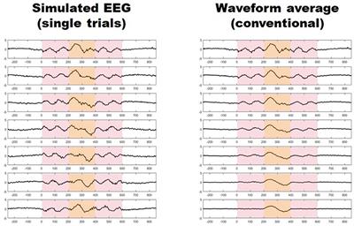 Brain Correlates of Single Trial Visual Evoked Potentials in Migraine: More Than Meets the Eye